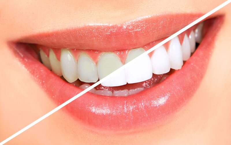 Quintessence Dental Clinic - Clinica stomatologica sector 1
