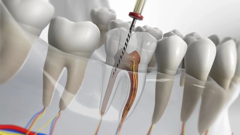Quintessence Dental Clinic - Clinica stomatologica sector 1